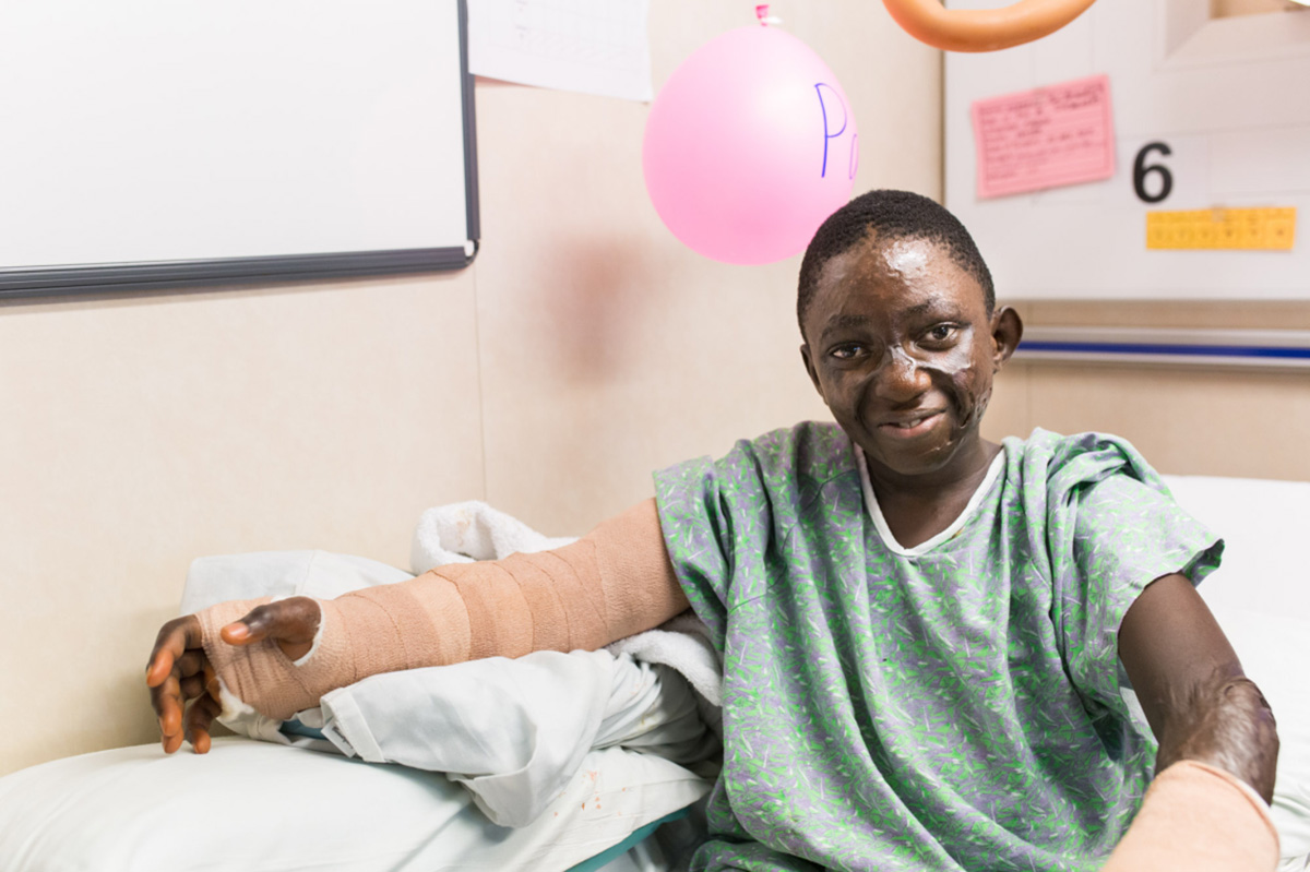 Patient Paul Bernard mit Verbrennungen nach seiner plastischen OP im Krankenzimmer