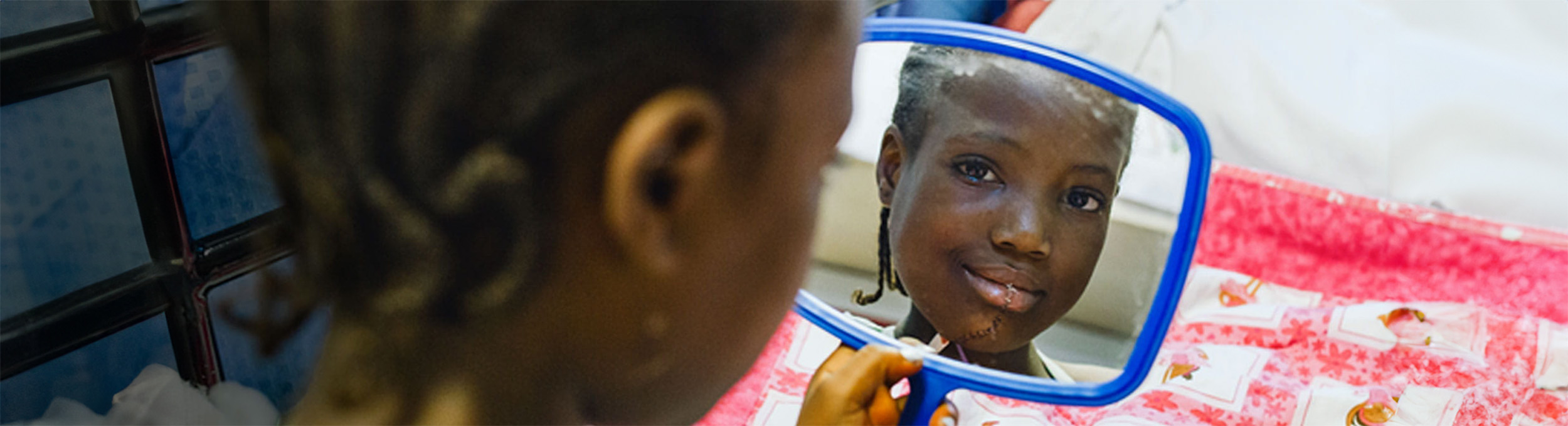 Houssainatou after her maxillofacial operation