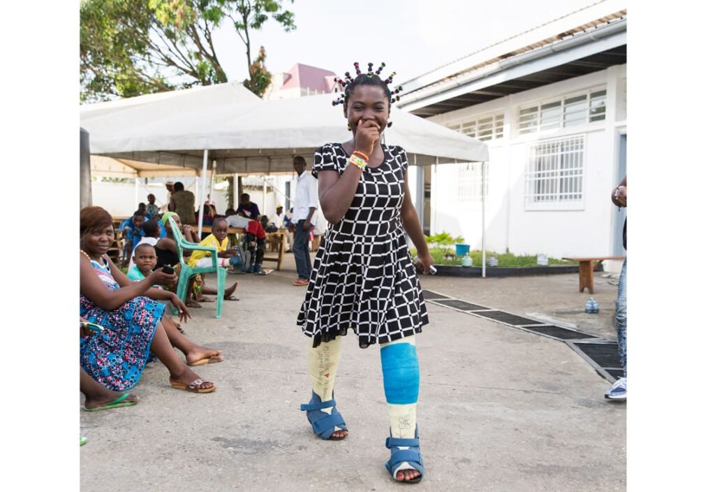 Julienne at the HOPE Center after her operation.